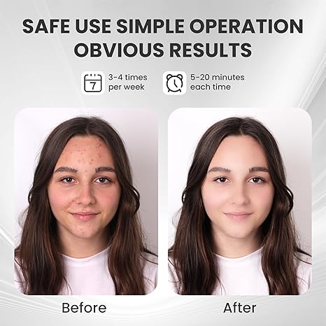 Color Light Face Mask - Skincare Therapy at Home